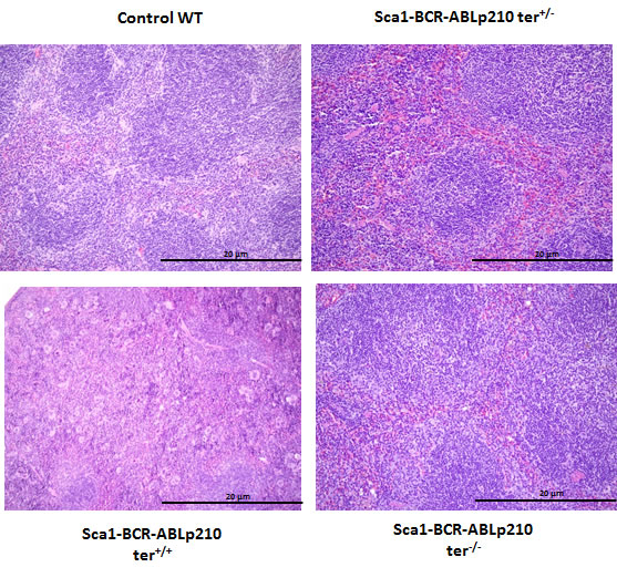 Telomerase is required for CML development in