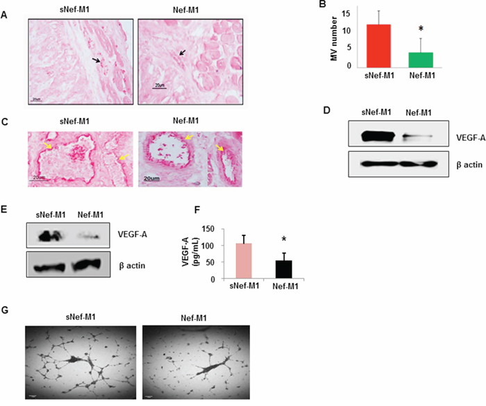 Effect of the Nef-M1 peptide on angiogenesis of CRC as determined by immunostaining for the endothelial marker CD31.