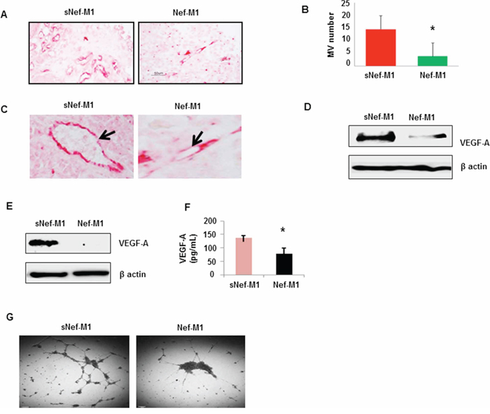 The effect of the Nef-M1 peptide on angiogenesis of BC as determined by immunostaining for CD31.