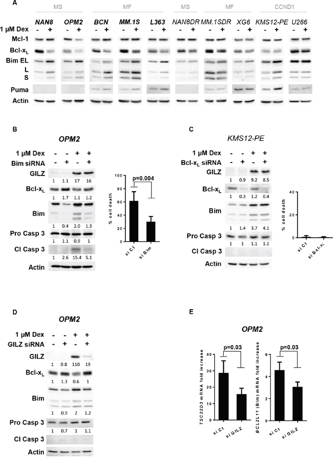 GILZ is involved in Bim up-regulation and Bcl-xL down-regulation associated with Dex-induced apoptosis.