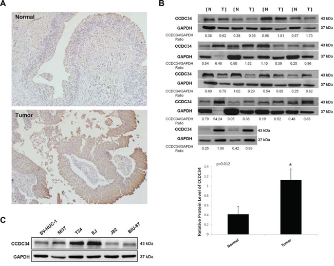 Increased expression of CCDC34 in human bladder cancer.