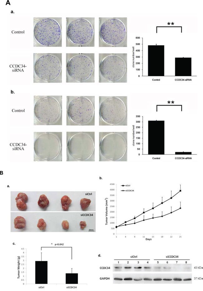 The growth-suppressive effect of CCDC34 knockdown on bladder cancer cells in vitro and in vivo.