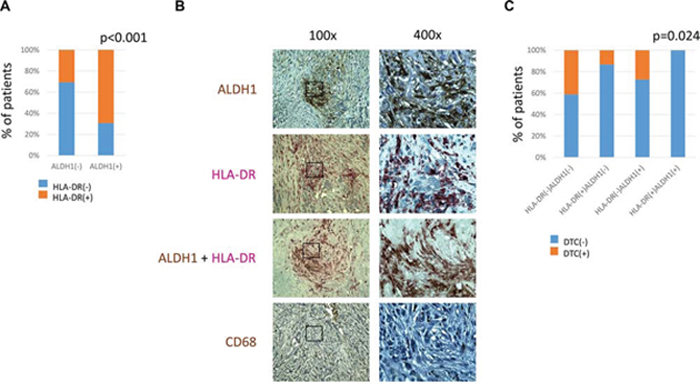 Comparison of ALDH1, CD68 and HLA-DR expression in stromal cells.