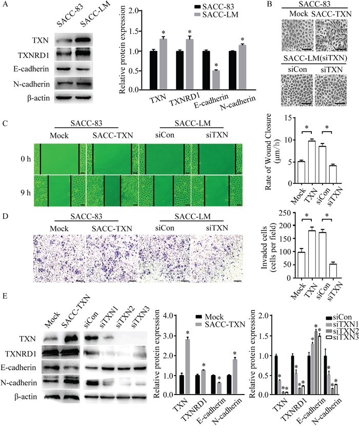 TXN modulates epithelial and mesenchymal proteins and promotes migration and invasion in SACC cell lines.