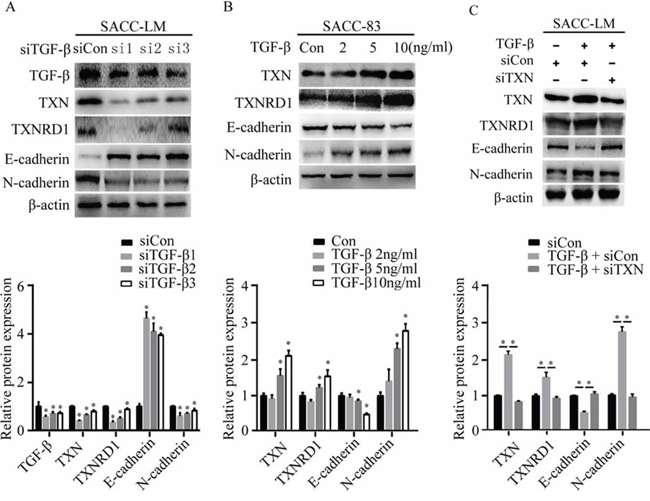 TXN is crucial for EMT induced by TGF-&#x03B2; in SACC cell lines.