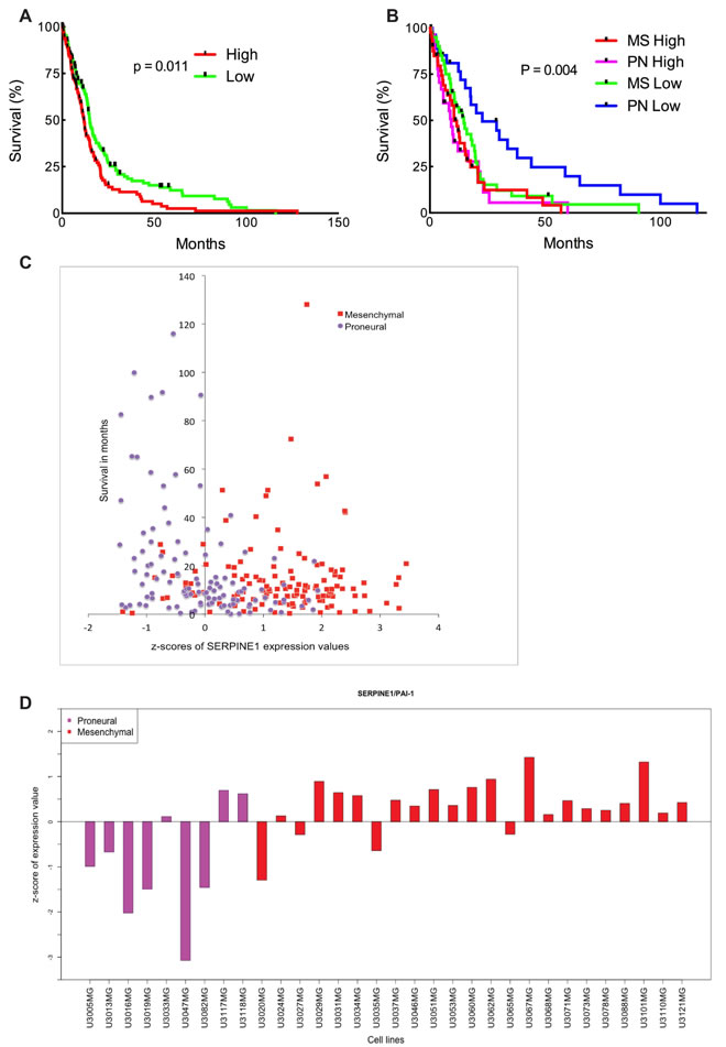 High SERPINE1 expression in human glioma correlates with low survival rate.