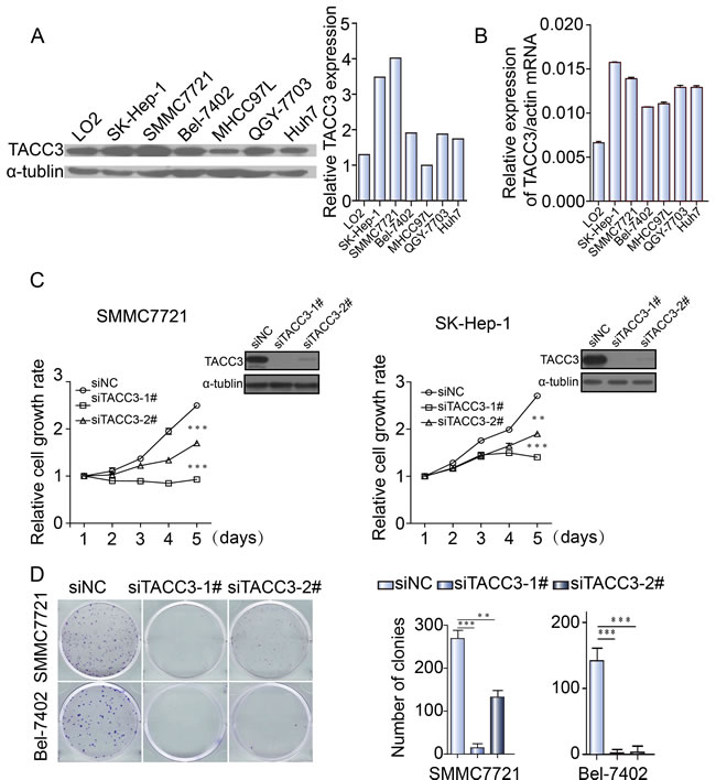 TACC3 knockdown suppresses the proliferation and clonogenicity of HCC cells