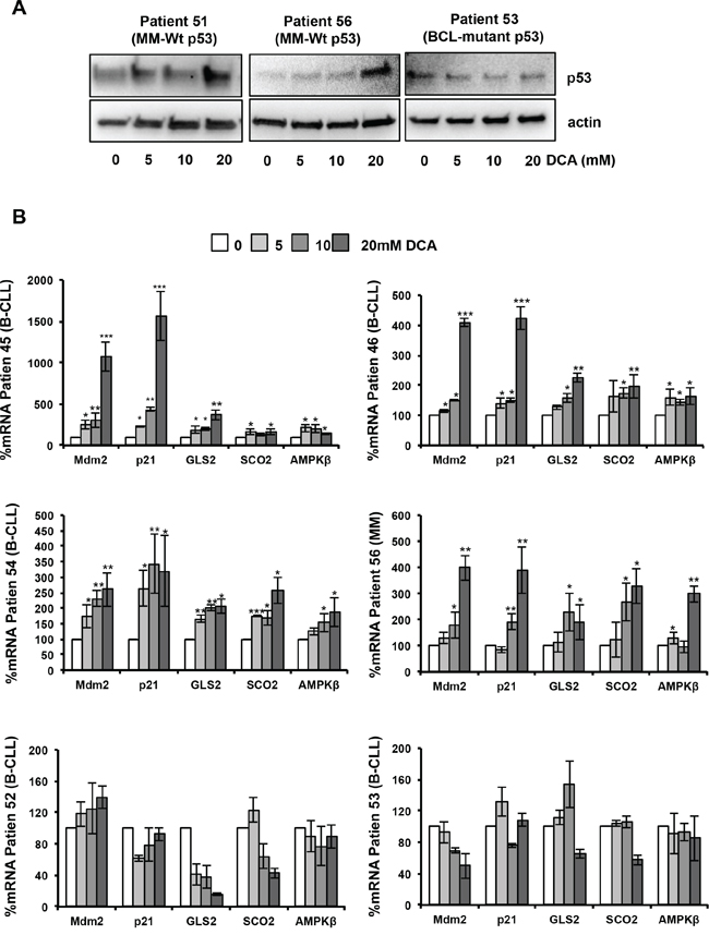 DCA activates the p53 pathway in primary leukemic cells.