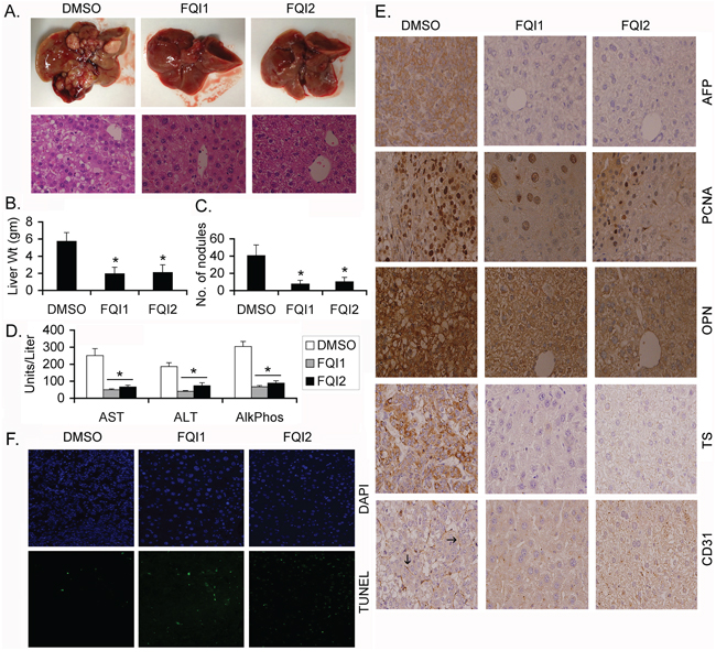 LSF inhibitors abrogate endogenous HCC in Alb/c-myc mice.