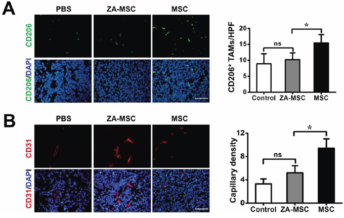 The analysis of neovascularization and TAMs migration of ZA-MSC treated tumor.