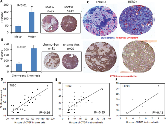 Protein expression of CTGF in PDX breast tumors.