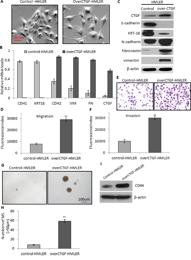 Enforced expression of CTGF promotes tumor cell migration, invasion, and mammosphere formation via EMT.