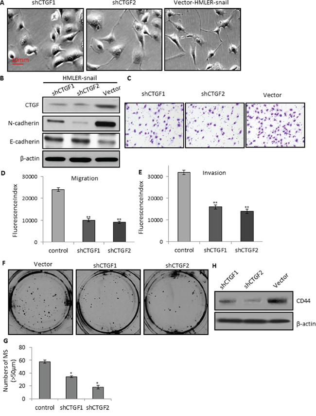 CTGF depletion reduces tumor cell migration, invasion, and mammosphere formation via MET.