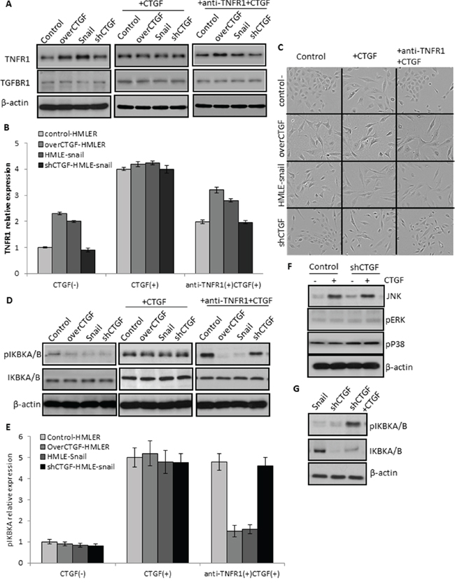 Essential role of TNFR1 in mediating the function of CTGF signaling.