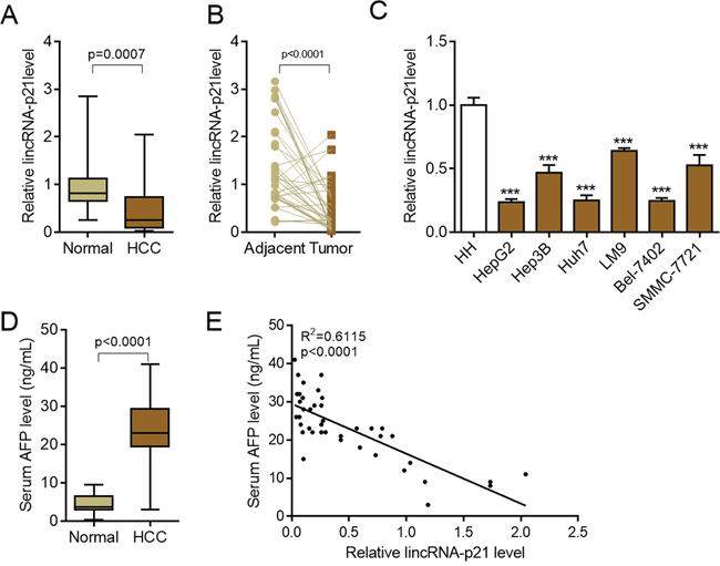 LincRNA-p21 is down-regulated in hepatocellular carcinoma.