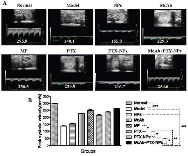 Ultrasound imaging of the BFV of renal arteries in MM mice.