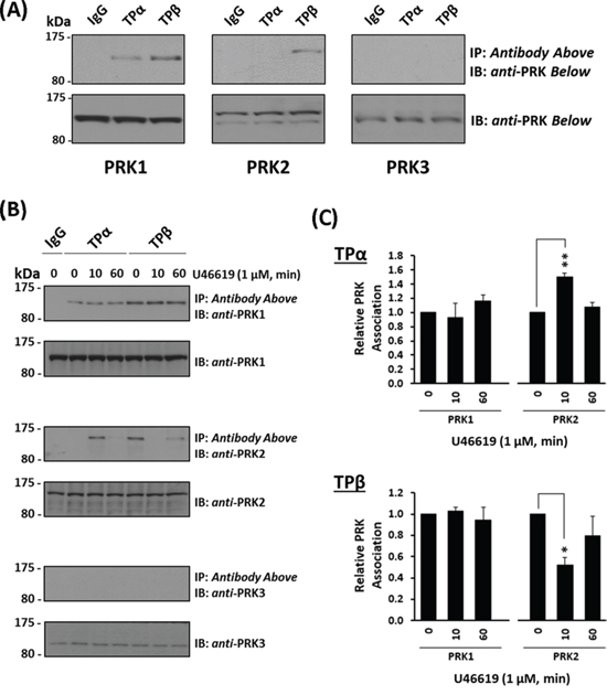 Association of PRK1 and PRK2 with TP&#x03B1; and TP&#x03B2; in prostate PC-3 cells.