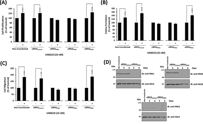 Effect of siRNA-mediated disruption of PRK1, PRK2 and PRK3 expression on TP agonist-induced proliferation and migration of PC-3 cells.
