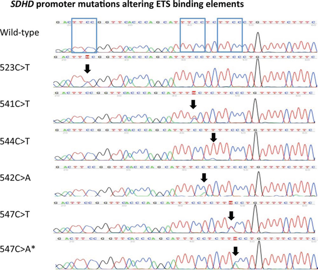 Recurrent SDHD promoter mutations altering ETS binding elements.