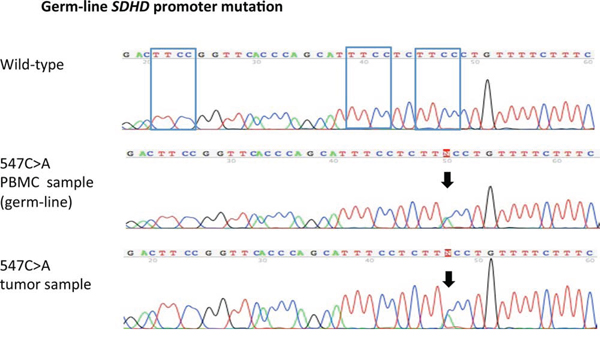 Germ-line SDHD promoter mutation.