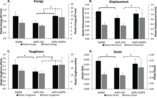 Mechanistic test results showed that ZIP4 silencing could improve mechanistic function of the bone.