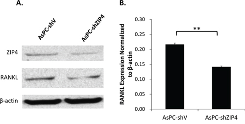 ZIP4 silencing down-regulated RANKL level under zinc-deficient condition.