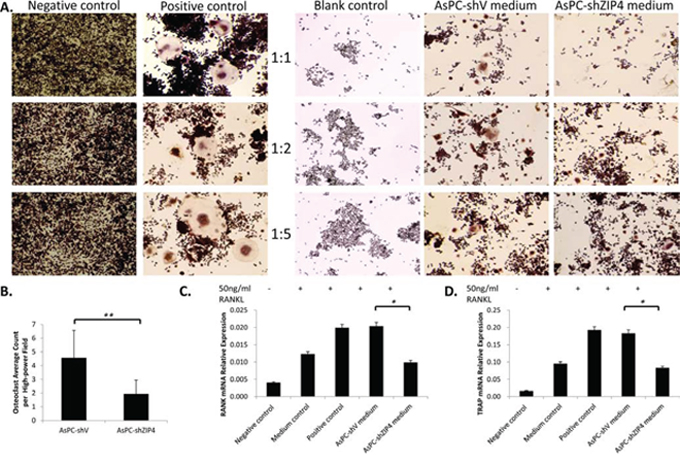 The differentiation of RAW264.7 cells to osteoclast was enhanced when culturing in the conditioned medium from AsPC-shV cells, compared with that from AsPC-shZIP4 cells.