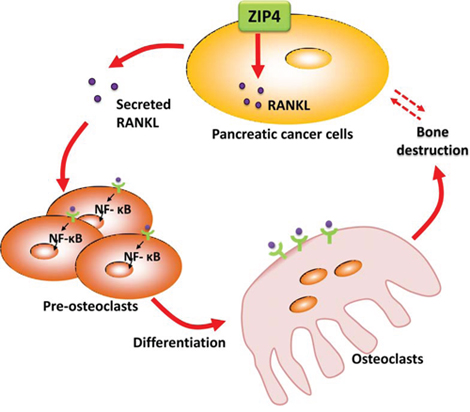 Diagram for ZIP4-induced bone loss in pancreatic cancer.