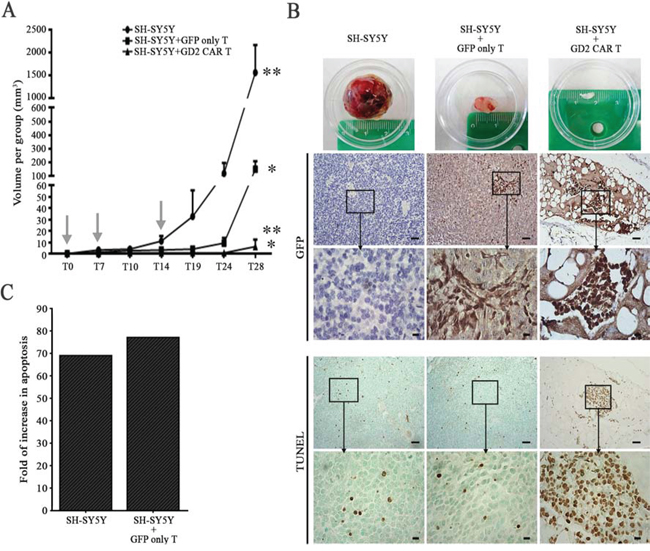 GD2 CAR T cells provide potent therapeutic activity in a neuroblastoma xenograft.