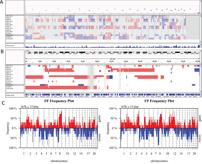 Analysis of Copy Number Variations (CNVs) in FF and FFPE tumor pairs.