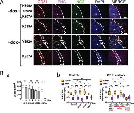 IRE1&#x03B1; RNase deficiency promotes growth of angiogenic and invasive Glioblastomas.