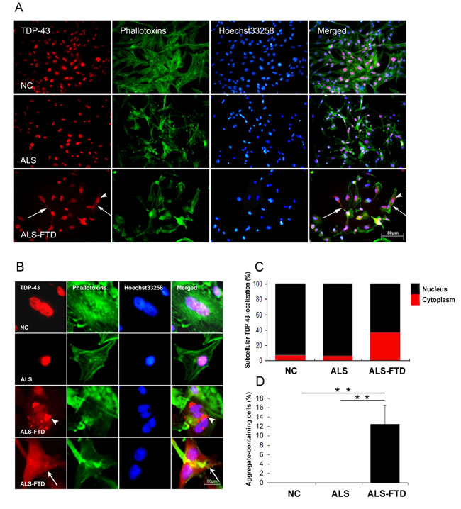 ALS-FTD-CSF induces intracellular mislocalization and aggregation of