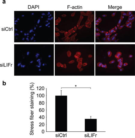 Knockdown of LIFr inhibits actin stress fiber induction.