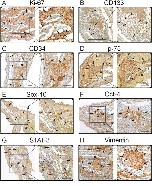 Expression of the proliferation and primitive markers in neoplasms of the transgenic animal.