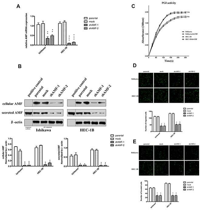 Effect of AMF gene silencing on EC cells migration and invasion.