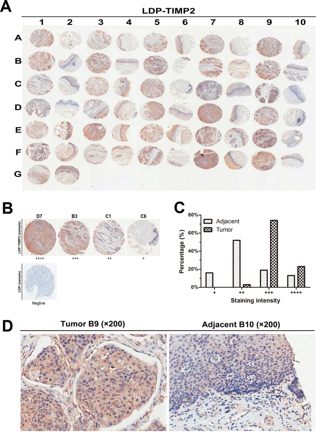 Binding affinity analysis via tissue microarray.