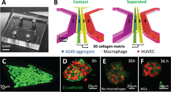 Microfluidic co-culture platform to study the interactions between carcinoma aggregates and macrophages.