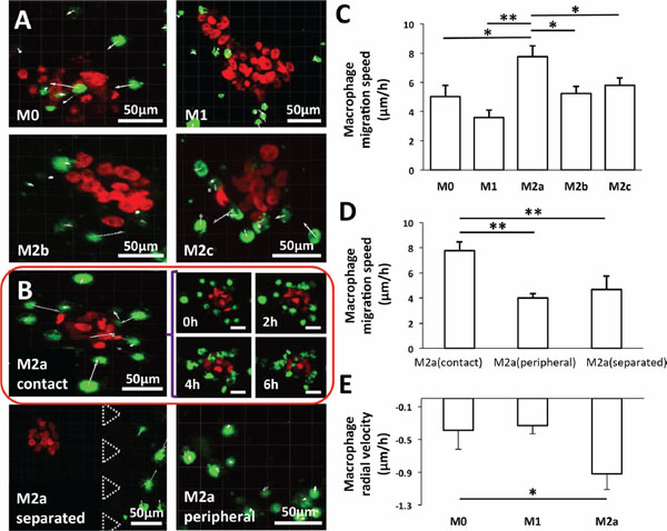 Migration of macrophage subtypes.