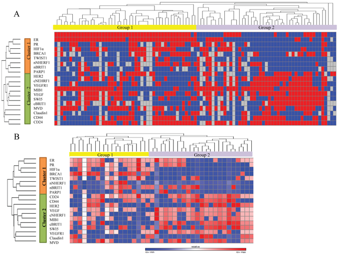 Unsupervised hierarchical analysis based on immunohistochemical score data and survival analysis.