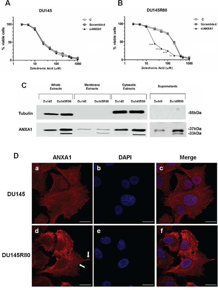 ANXA1 involvement in DU145R80 PCa cell resistance to ZA.