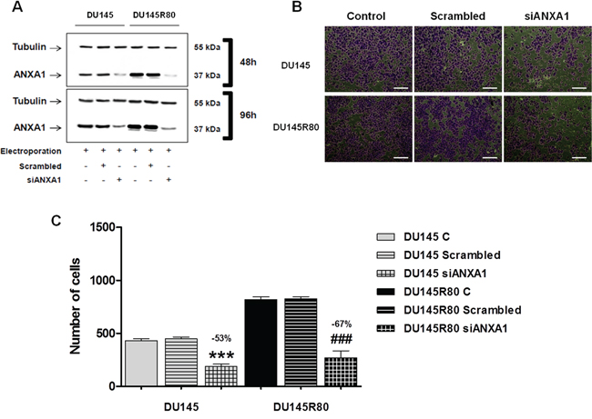 ANXA1 knockdown effects on DU145 and DU145R80 cell invasion capability.