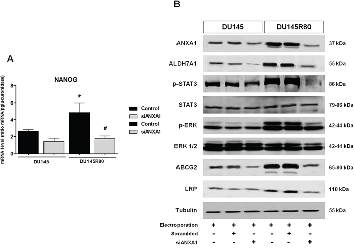 ANXA1 expression correlates with CSC-like phenotype in ZA-resistant DU145R80 PCa cells.