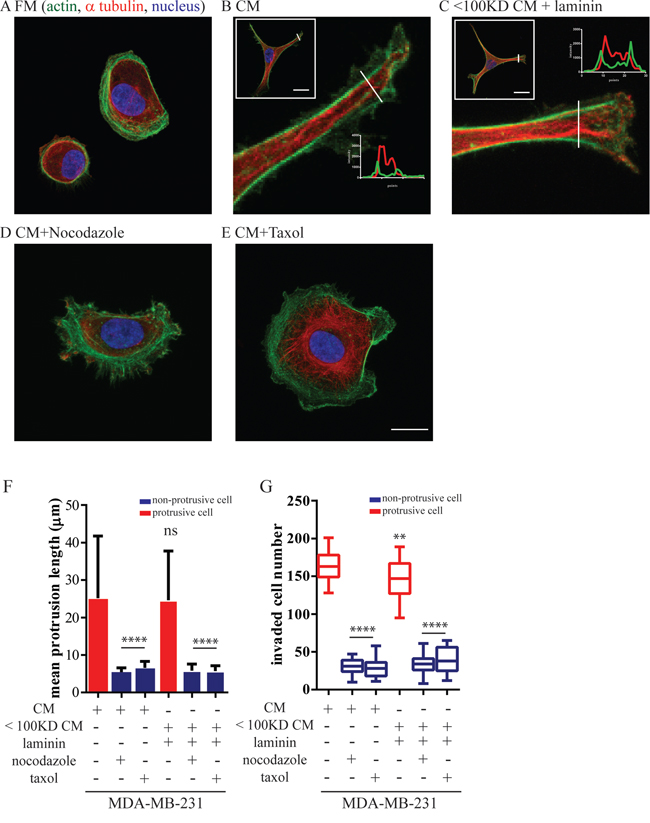 Mammary epithelium cells-induced protrusions depend on microtubule dynamics.