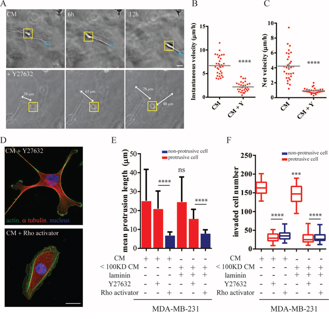 Cell contraction is necessary for protrusion-led invasion.