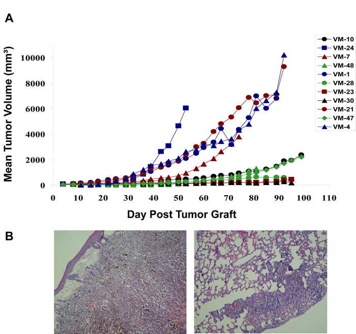 Subcutaneous growth of the indicated 11 human melanoma cell models in immuno-compromised mice.