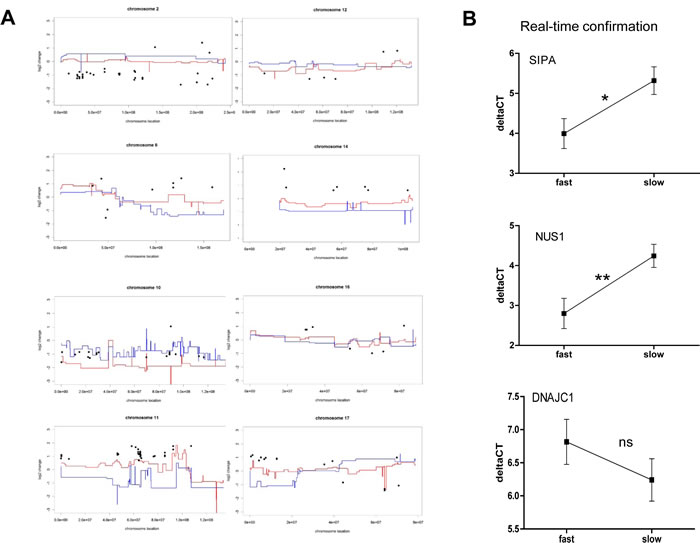 Aneuploidy-driven gene expression deregulation underlies aggressiveness of melanoma xenograft models.