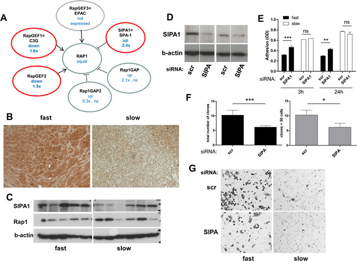 The Rap1 deactivator SIPA1 is gained at the DNA level as well as overexpressed in aggressive melanoma models and impacts on cell behaviour.