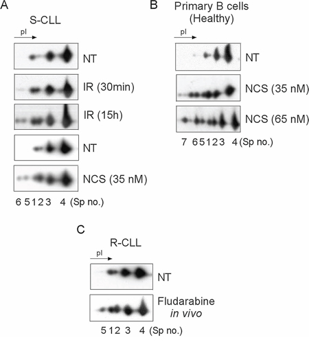 Ku70 phosphorylation after DNA DSB induction is dose- and post-treatment time-dependent in cellulo and in vivo following fludarabine treatment.