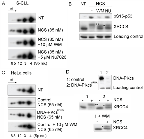 DNA DSB-induced phosphorylation of Ku70 requires DNA-PKcs activity in CLL cells.