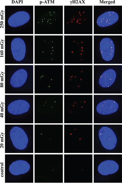 Representative images of &#x03B3;H2AX and pATM foci and their co-localization at 30 min post-irradiation.